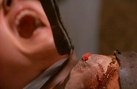 Ripping the breast...
