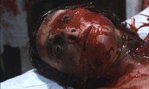 Tortured victim...