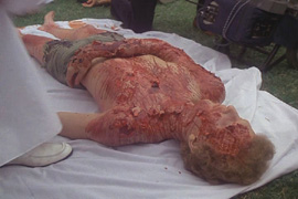A corpse :)